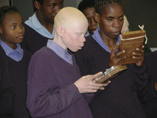Aufklärung über Albinismus in Namibia.